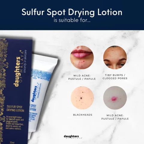 Daughters Of Malaya - Sulfur Spot Drying Lotion (SSDL)